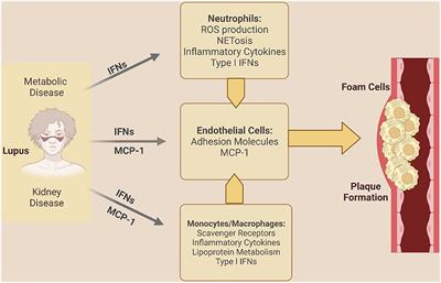 Coronary Microvascular Dysfunction in Patients With Systemic Lupus Erythematosus and Chest Pain